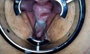 Cervix play and gaping pussy.