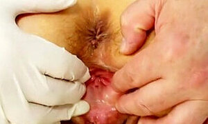 Czech Granny Likes Everything Her Gynecologist Is Doing With Her Pussy, When She Visits Him